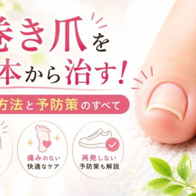 巻き爪を根本から治す！矯正方法と予防策のすべて