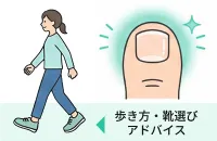 巻き爪予防のアドバイスをイメージしたイラスト