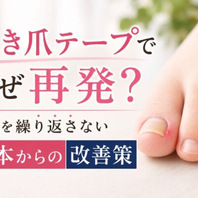 巻き爪テープでなぜ再発？