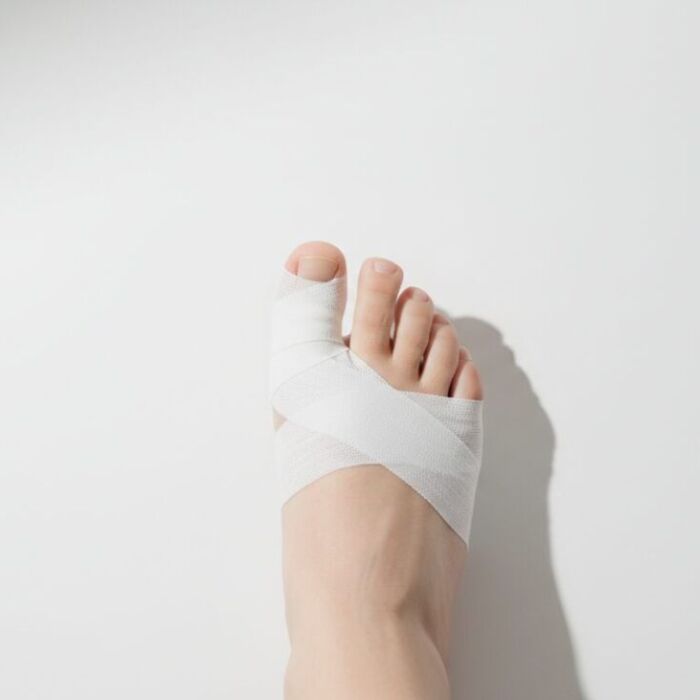 little-toe-pain-taping-ineffective-thumbnail