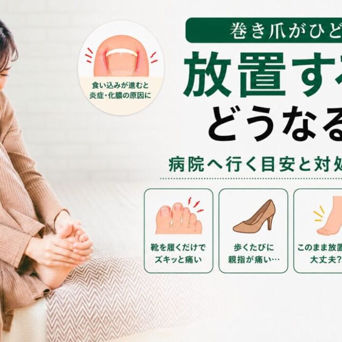 巻き爪の症状と対処法
